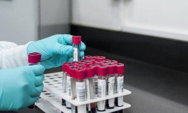 Τσακρής για ευλογιά των πιθήκων: Η νέα παραλλαγή προκαλεί σοβαρότερες λοιμώξεις