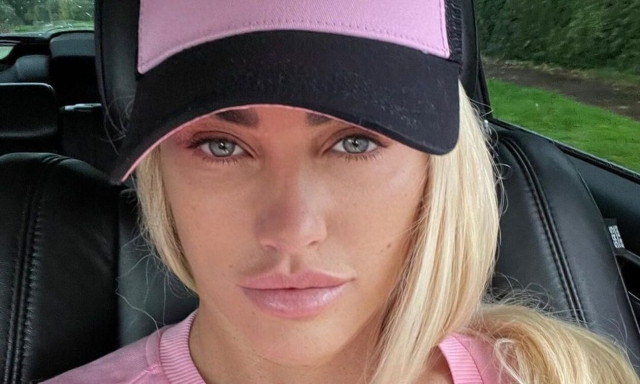 Κέιτι Πράις: Aν δεν σταματήσει τις πλαστικές επεμβάσεις θα πεθάνει