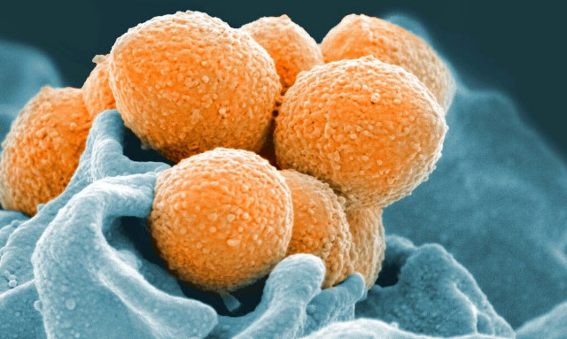 Ισπανία: Δύο θάνατοι έπειτα από λοιμώξεις με στρεπτόκοκκο Α