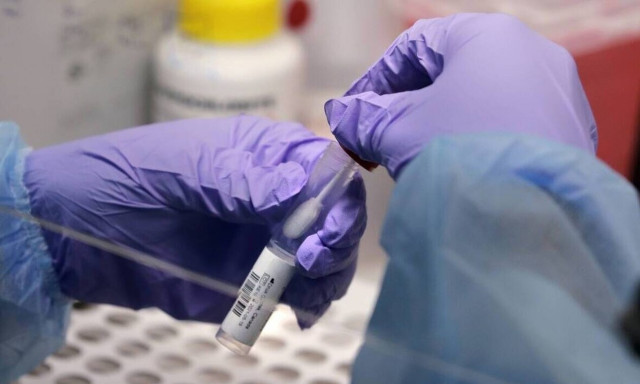 «Καμπανάκι» Παρασκευή: Σε έξαρση οι ιώσεις αναπνευστικού