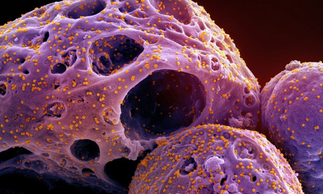 Μετάλλαξη «Kraken»: Πότε θα έρθει στην Ευρώπη – Οι οδηγίες του ECDC