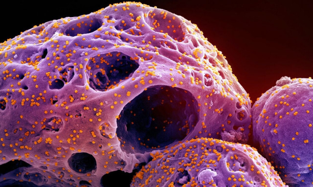 Politico: H μετάλλαξη «Κράκεν» θα έρθει στην Ευρώπη, αλλά όχι ακόμη