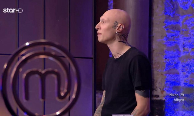 MasterChef: Συγκίνησε παίκτης με αλωπεκίαση - «Ξύπνησα και τα μισά μου μαλλιά ήταν στο κρεβάτι»