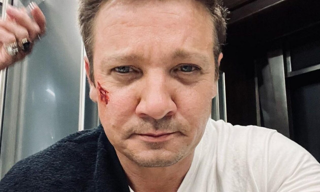 Τζέρεμι Ρένερ: Έσπασε πάνω από 30 οστά - Η ανάρτηση στο Instagram