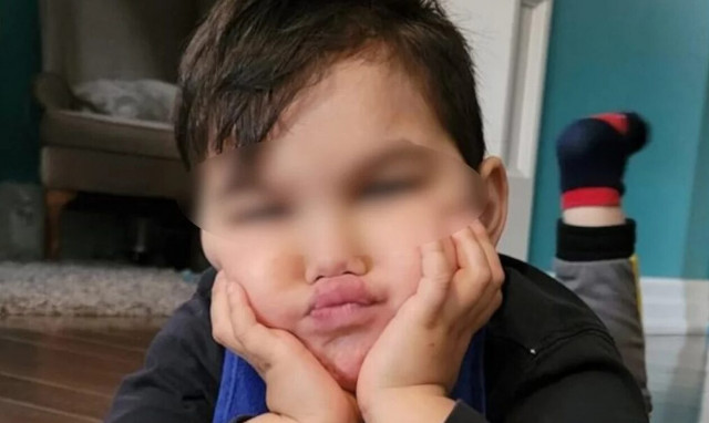 Κρήτη: Έχασε τη ζωή ο 5χρονος που πάλευε με τον καρκίνο