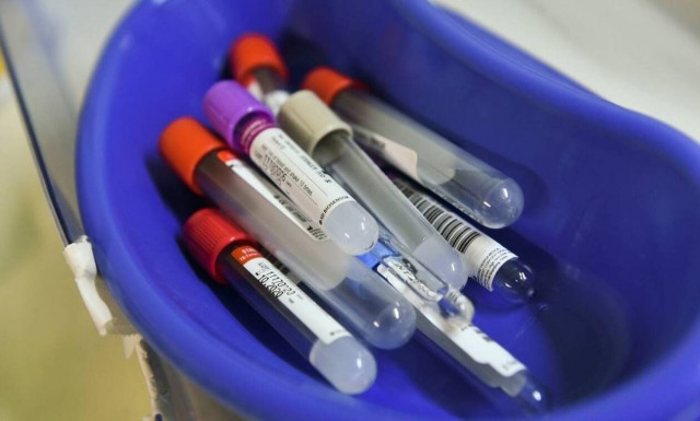 Σκέψεις για φίλτρα στη συνταγογράφηση εξετάσεων για περιορισμό του clawback