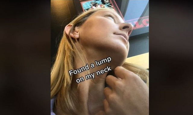 Ανακάλυψε ότι έχει καρκίνο χάρη σε ένα viral trend στο Tik Tok