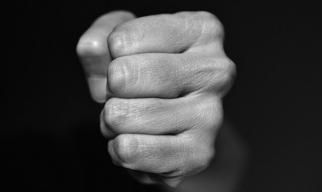 Άγριο ξύλο μεταξύ νεαρών στο κέντρο της Κοζάνης – Στο νοσοκομείο με τραύματα στο κεφάλι 20χρονος