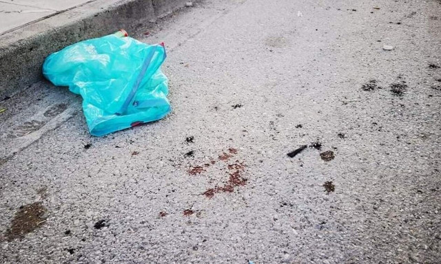 Ζεφύρι: Στο «Αγλαϊα Κυριακού» νοσηλεύεται η 5χρονη που τραυματίστηκε από «αδέσποτη» σφαίρα