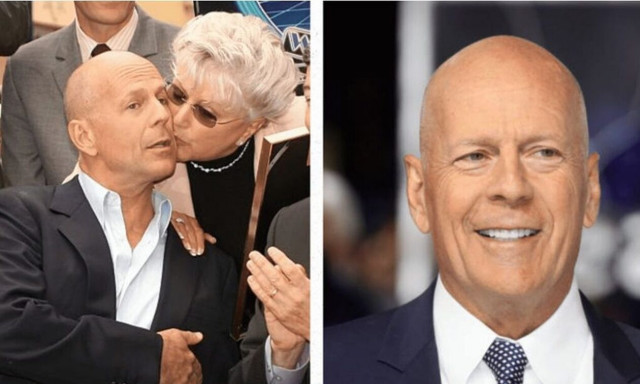 Μπρους Γουίλις: Δεν αναγνωρίζει ούτε τη μητέρα του