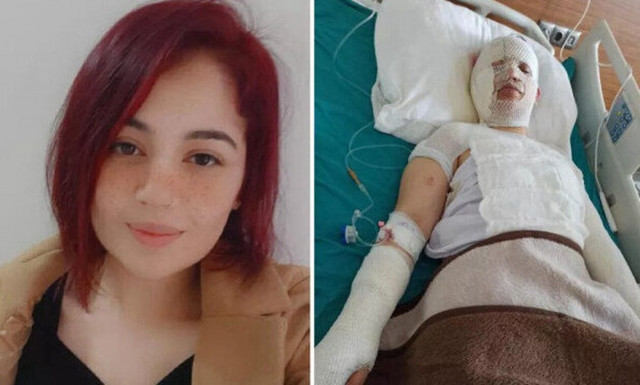 Τουρκία: Γλίτωσε από τον σεισμό αλλά όχι από τον πρώην της - Την ζεμάτισε με καυτό νερό