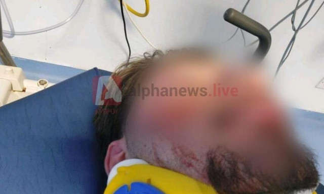 Κύπρος: «Κλώτσησαν στο κεφάλι τον έναν μου γιο, προσπάθησαν να πνίξουν τον άλλο»(vid)