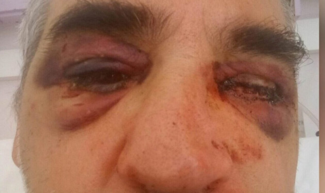 Μύκονος - Επίθεση σε αρχαιολόγο: «Είχε δεχθεί πιέσεις από ιδιώτες», λέει η δικηγόρος του θύματος