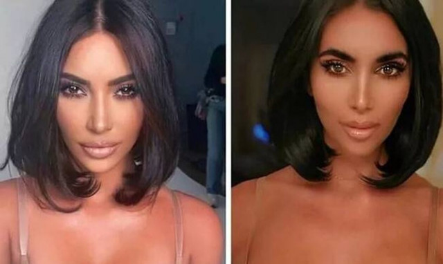 Ashten Empire: Η 28χρονη που ξόδεψε μία περιουσία σε πλαστικέςγια να της μοιάσει στην Κιμ Καρντάσιαν