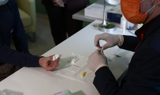 Ξεκινά το μητρώο ασθενών με HIV και η ηλεκτρονική συνταγογράφηση αντιρετροϊκής αγωγής