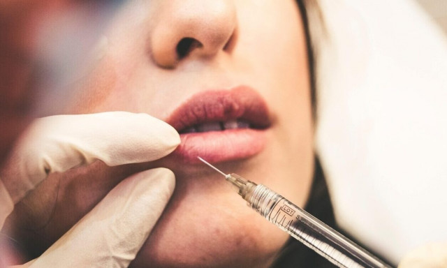 ΗΠΑ: TikToker δείχνει πώς μοιάζει το πρόσωπό της μετά από 20 χρόνια Botox