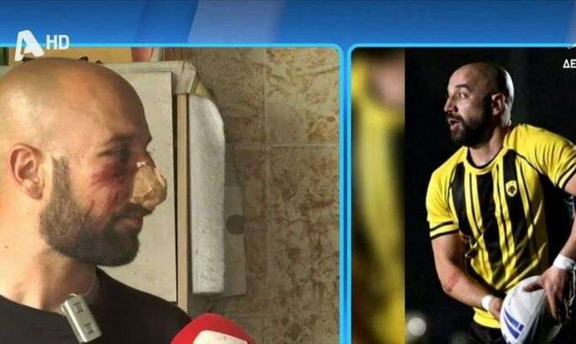 Ξυλοκοπήθηκε άγρια αθλητής της ΑΕΚ – Μάρτυρας η μητέρα του που ούρλιαζε