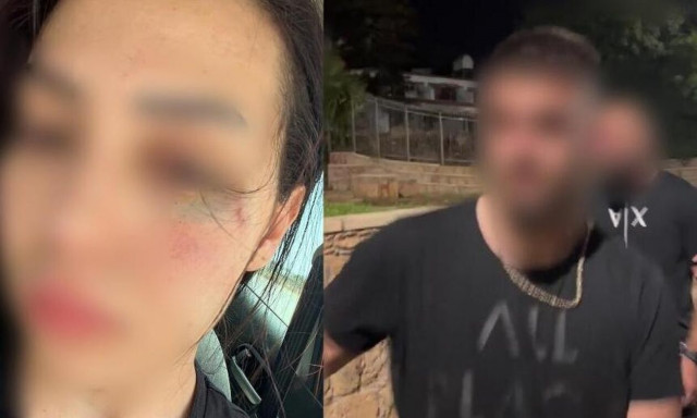 Kύπρος - Θύμα επίθεσης: «Δεν θέλω ο ξυλοδαρμός μου να φέρει ένταση κι εχθρότητα στις δύο κοινότητες»