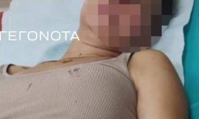 Βόλος: Σοκάρουν οι εικόνες της 30χρονης που ξυλοκοπήθηκε από διεθνή αθλητή, πρώην σύζυγό της