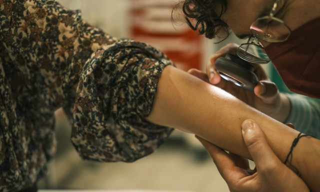 Δωρεάν έλεγχος σπίλων σε 8 ακριτικά νησιά - Βρέθηκαν 58 ύποπτα περιστατικά