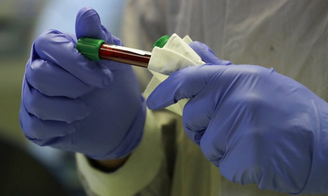 Κορονοϊός: Γιατί κάποιοι είναι ασυμπτωματικοί - Βρέθηκε γενετική μετάλλαξη