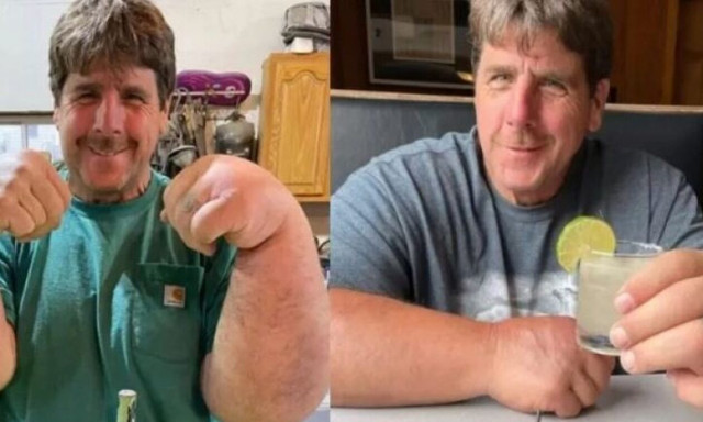 Ο αληθινός Ποπάυ: Άλυτο παραμένει το μυστήριο γύρω από τον άνθρωπο που γεννήθηκε με ογκώδη χέρια