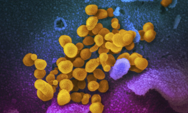 Κορονοϊός - ΕΟΔΥ: Στο 11% των κρουσμάτων η μετάλλαξη Eris