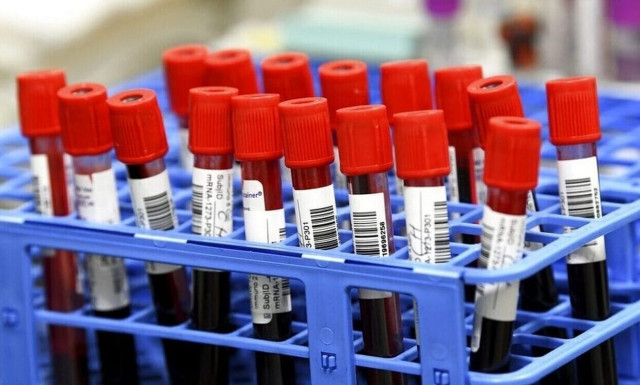 Κορονοϊός: Ποια είναι τα συμπτώματα της παραλλαγής «Eris» - Τι λέει η Ματίνα Παγώνη