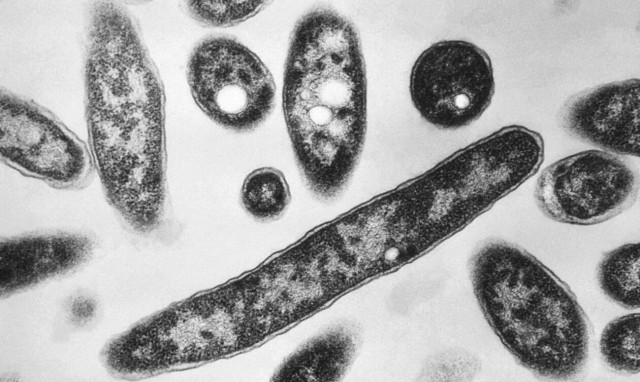 Eπιδημία της νόσου των λεγεωνάριων στην Πολωνία