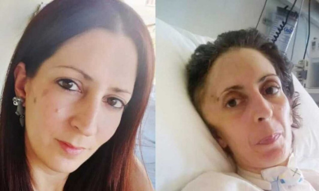 Αργυρούπολη: Μνημείο για την 41χρονη που πέθανε μετά από άγριο ξυλοδαρμό του συντρόφου της