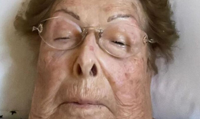 Βέφα Αλεξιάδου: Καταβεβλημένη στο κρεβάτι του νοσοκομείου - Η φωτογραφία στο Facebook