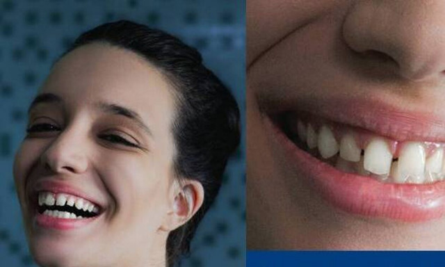 Νέα καμπάνια ΑΙΜ - «Πέρα από τα μπροστινά μας δόντια»