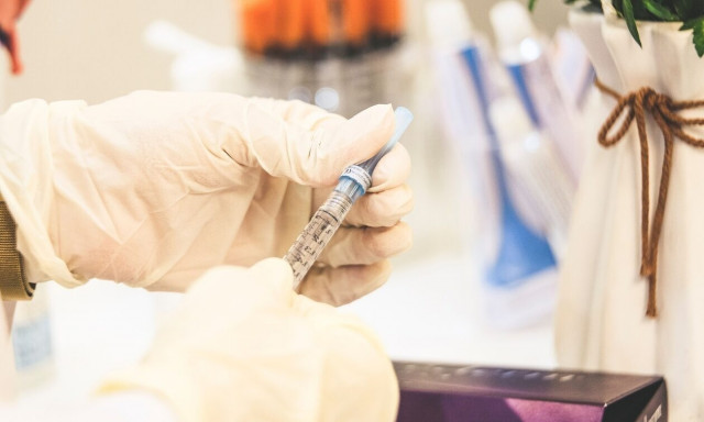 Υπουργείο Υγείας: Δεν υπάρχουν ελλείψεις φαρμάκων στην αγορά