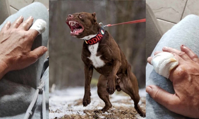 Ηγουμενίτσα: Στο νοσοκομείο γυναίκα μετά από επίθεση πίτμπουλ – Την τραυμάτισε και στα δύο χέρια