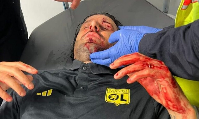 Γαλλία: Επίθεση με πέτρες στο πούλμαν της Λιόν - Αιμόφυρτος ο Φάμπιο Γκρόσο | Σκληρές εικόνες