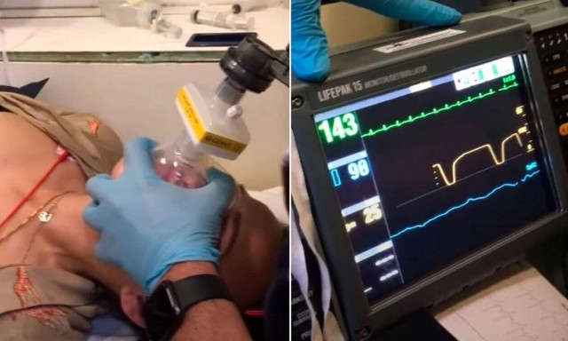 Θεσσαλονίκη: Συγκλονίζει ο γιατρός που έσωσε την 39χρονη μετά από το δάγκωμα οχιάς