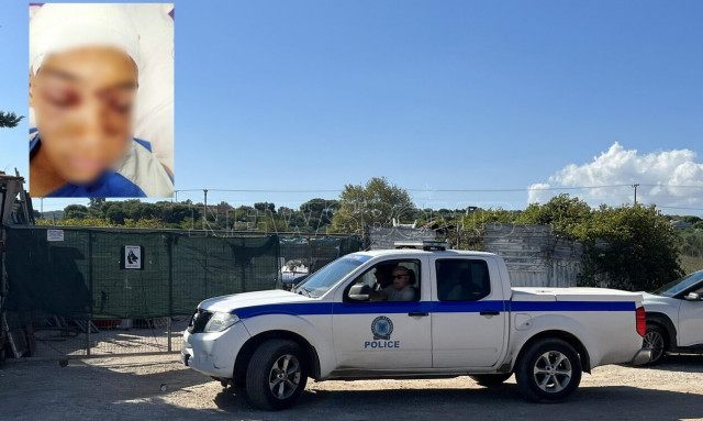 Αρτέμιδα - Πατέρας 11χρονου: «Το παιδί μου ήταν μέσα στα αίματα, τον δάγκωσε παντού το πιτ μπουλ»