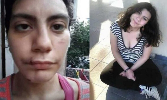 Φαίη Μπακογιώργου: Πιθανή και τρίτη δολοφονία, λέει η δικηγόρος του πατέρα της 23χρονης