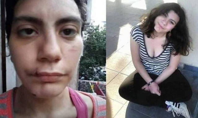 Φαίη Μπακογιώργου: «Σταμάτα να με βαράς δεν μπορώ άλλο» - Σοκαριστική μαρτυρία