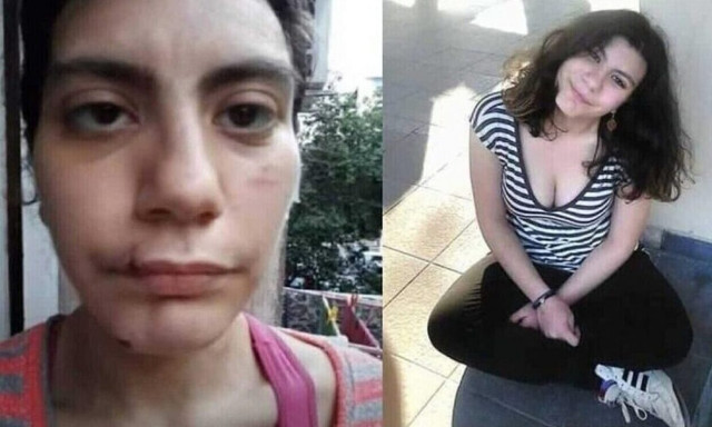 Φαίη Μπακογιώργου: Μάρτυρες υποστηρίζουν ότι είδαν τη σορό με αίματα στο κεφάλι