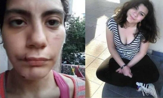 Φαίη Μπακογιώργου: «Την πάτησα στο λαιμό μέχρι να σταματήσει να αναπνέει, θα το έκανα ξανά»