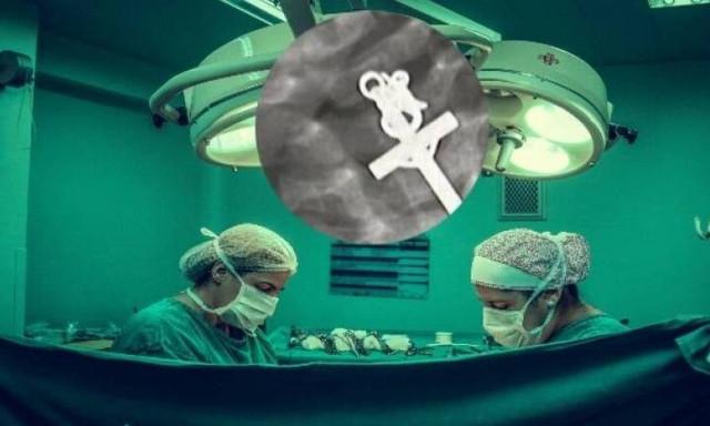 Γιατροί στο Περού ξαφνιάστηκαν όταν βρήκαν σταυρό στον οισοφάγο ενός παιδιού: Σώθηκε από θαύμα (vid)