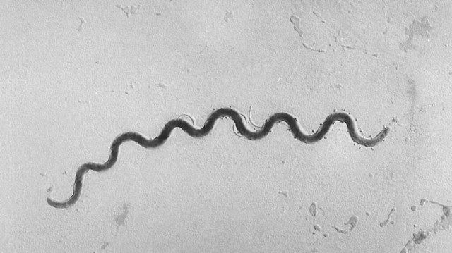 Γερμανία: Αυξήθηκαν τα περιστατικά σύφιλης και ηπατίτιδας - Συναγερμός στις υγειονομικές Αρχές