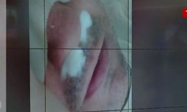 Καλαμάτα: Τι λέει ο γονέας που ξυλοκοπήθηκε έξω από δημοτικό σχολείο - «Έχουμε κάνει μήνυση»