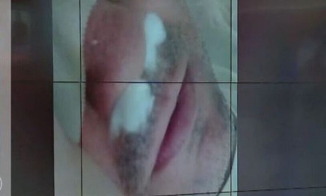 Καλαμάτα: «Δεν έγινε κανένας ξυλοδαρμός», αναφέρει το περιβάλλον του φερόμενου ως δράστη