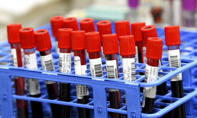 Εξέταση αίματος για τη γήρανση των οργάνων «προβλέπει» τον κίνδυνο ασθενειών