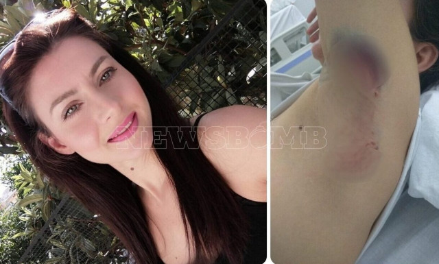 Συγκλονίζει η Αγάπη Κωστέα: Είμαι ζωντανή νεκρή από την επίθεση των σκυλιών - Βλέπω εφιάλτες