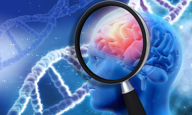 Πίνοντας αυτό το ρόφημα «προσκαλείτε» την νόσο Αλτσχάιμερ. - Και δεν είναι ο καφές