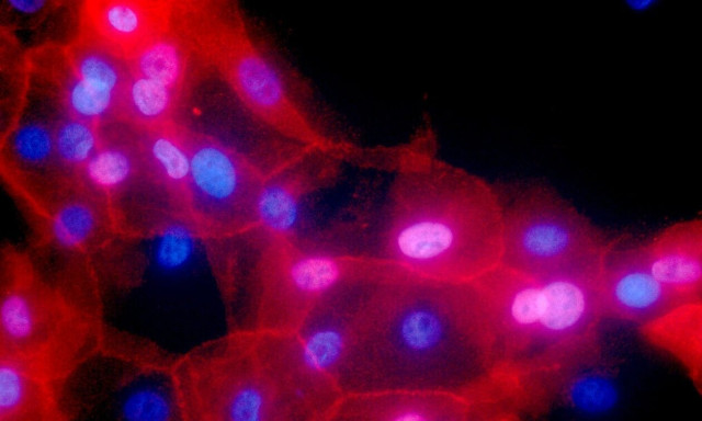 ΕΚΠΑ: Ιατρική ακριβείας με την ανάλυση του πλήρους γονιδιώματος του όγκου