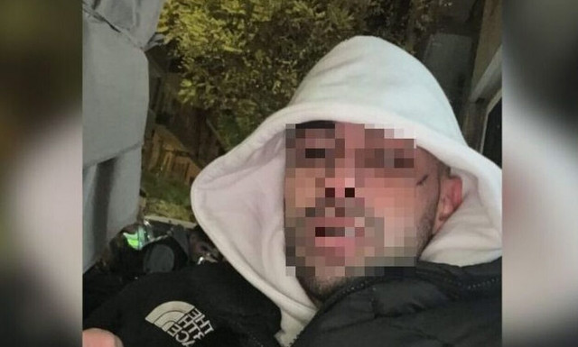 Θεσσαλονίκη: «Είναι ευαίσθητο άτομο» λέει ο δικηγόρος του ράπερ που έστειλε στην ΜΕΘ φοιτητή